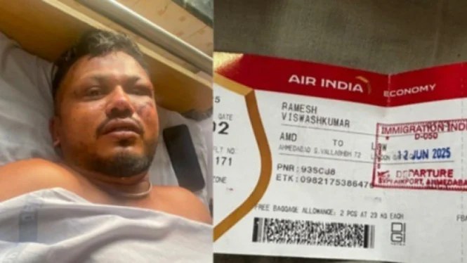 Vishwash Kumar Ramesh Di Rumah Sakit Setelah Selamat Dari Kecelakaan Pesawat Air India Ai171